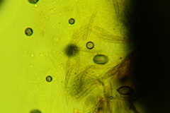 Leptosphaeria acuta