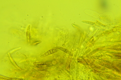 Leptosphaeria acuta