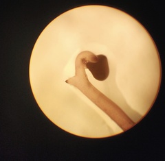 Chondracanthus acicularis