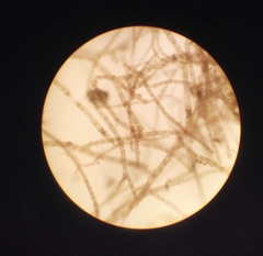 Chondracanthus acicularis