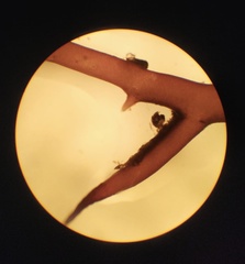 Chondracanthus acicularis