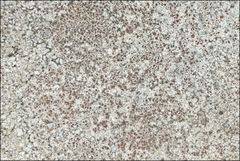 Lecanora pseudistera