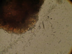 Entomophthorales