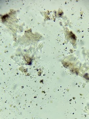 Arthonia diffusella