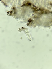 Arthonia diffusella