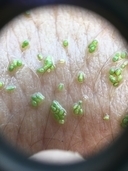 Wolffia brasiliensis