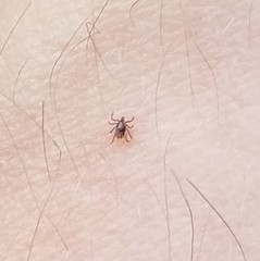 Ixodes ricinus