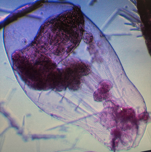 Asplanchna