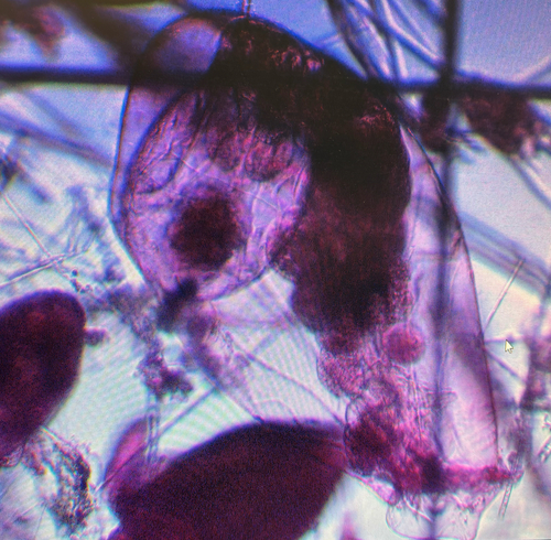 Asplanchna