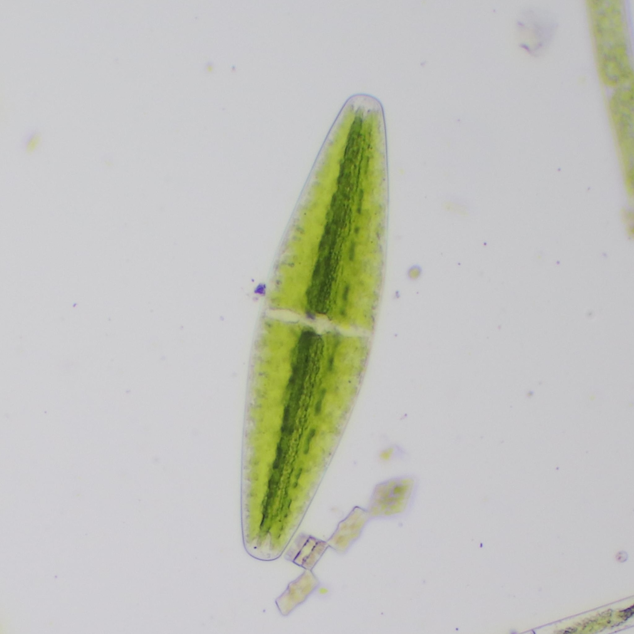 Netrium digitus var. digitus