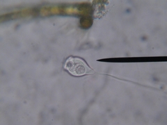 Vorticella