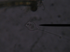 Vorticella