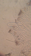 Acarospora versicolor