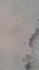 Acarospora versicolor