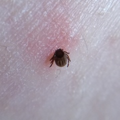 Ixodes ricinus
