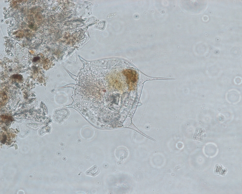 Brachionus quadridentatus