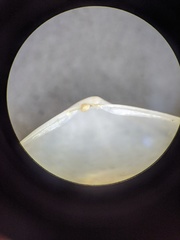 Rhamphidonta retifera