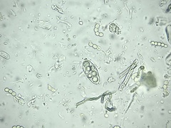Enchylium limosum
