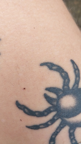 Castor bean tick