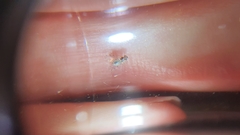 Ectopsocidae