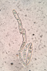 Echinosphaeria strigosa