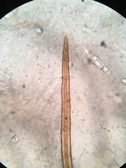 Echinosphaeria strigosa