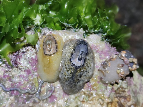 Macroschisma dilatatum