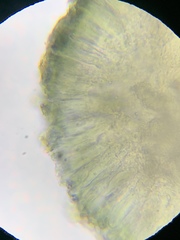 Strangospora moriformis