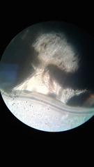 Pseudoschismatomma rufescens