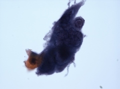 Human alphaherpesvirus one