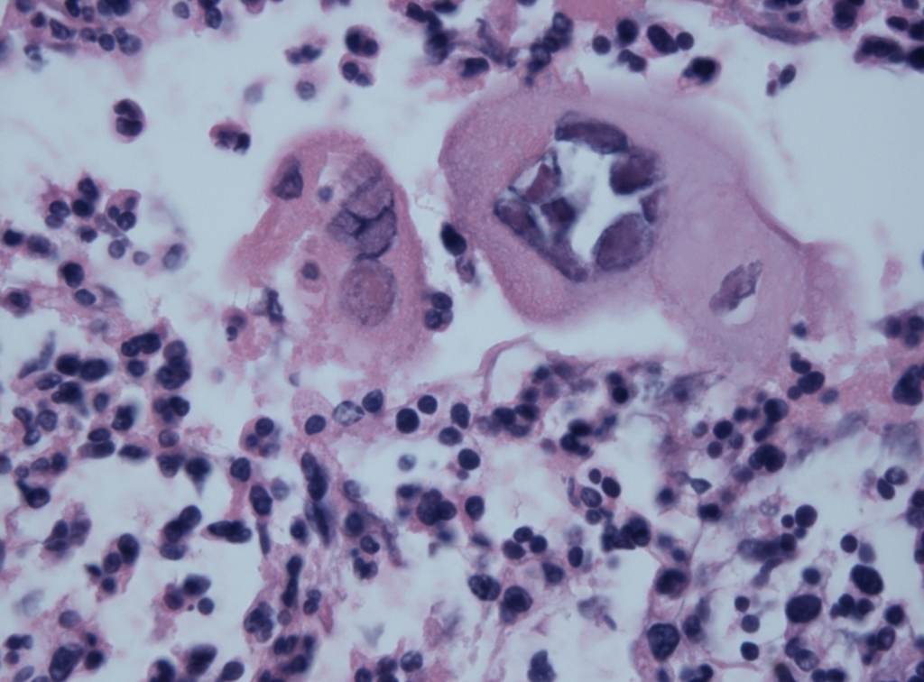 Herpesviruses