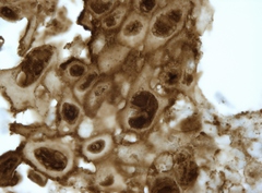 Human alphaherpesvirus one