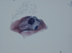 Alphapapillomavirus ten