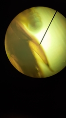 Ptychostomum pallens