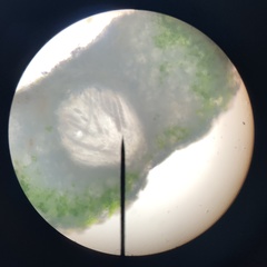 Pertusaria paratuberculifera