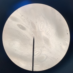 Pertusaria paratuberculifera