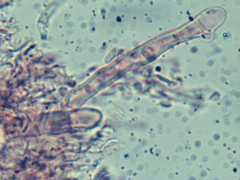 Hyphoderma