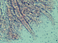Hyphoderma
