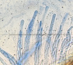 Cercophora silvatica