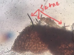 Lophiostomataceae