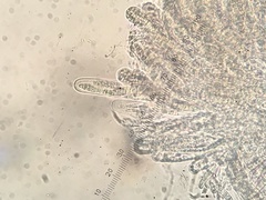 Lophiostomataceae