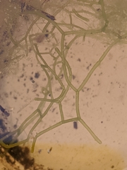 Hydrodictyon reticulatum