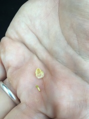 Haemorhous purpureus