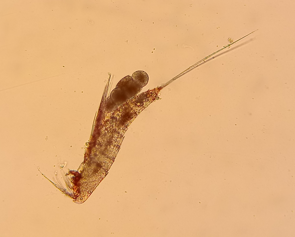 Microsetella norvegica