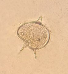 Protoperidinium bipes