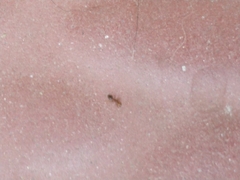 Solenopsis