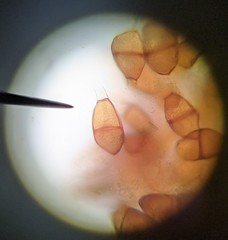 Puccinia liliacearum