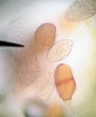 Puccinia liliacearum