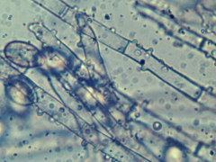 Botryobasidium conspersum