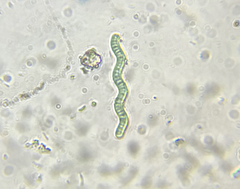 Arthrospira jenneri